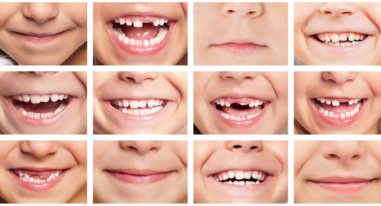 Ортодонтія Луцьк — брекети елайнери Філігранно